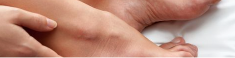 Feet and Ankle Eczema